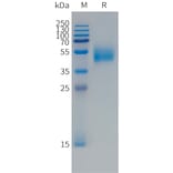 SDS-PAGE - Recombinant Human FCRL5 Protein (Fc Tag) (A324991) - Antibodies.com