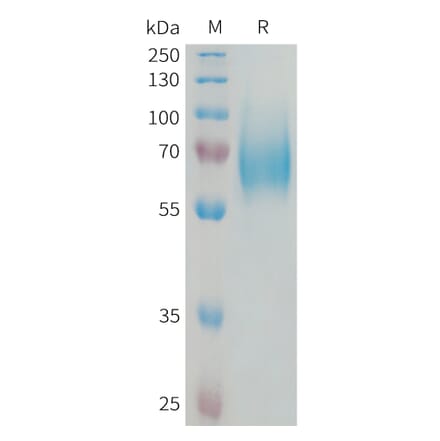 SDS-PAGE - Recombinant Human FGFR1 Protein (6xHis Tag) (A324992) - Antibodies.com