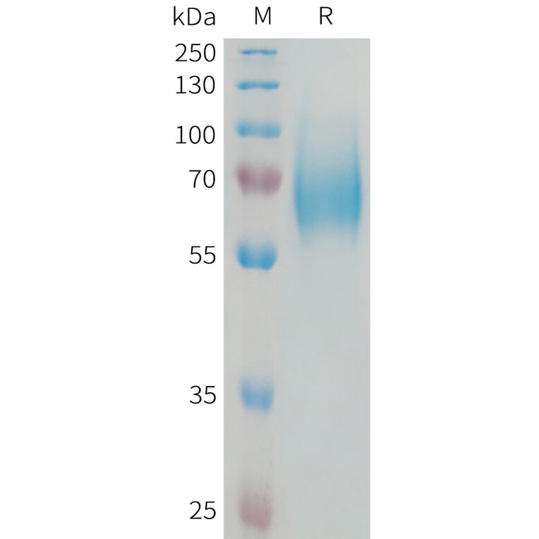 SDS-PAGE - Recombinant Human FGFR1 Protein (6xHis Tag) (A324992) - Antibodies.com