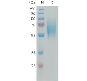 SDS-PAGE - Recombinant Human FGFR2 Protein (6xHis Tag) (A324993) - Antibodies.com