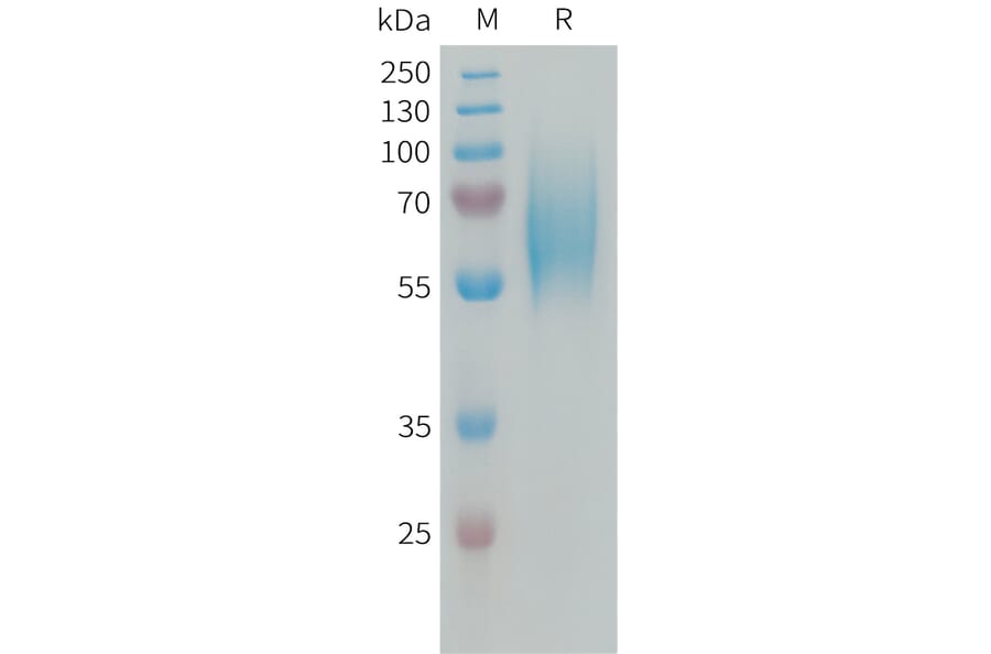 SDS-PAGE - Recombinant Human FGFR2 Protein (6xHis Tag) (A324993) - Antibodies.com