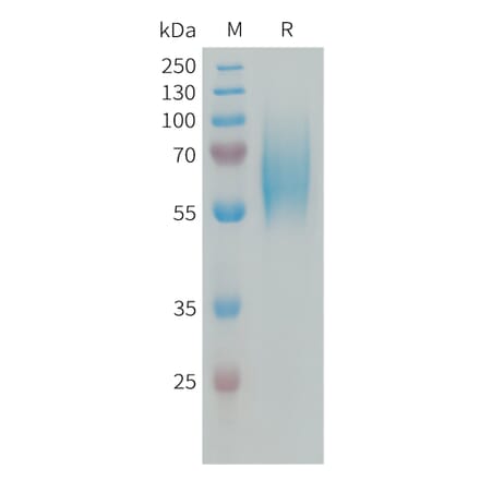 SDS-PAGE - Recombinant Human FGFR2 Protein (6xHis Tag) (A324993) - Antibodies.com