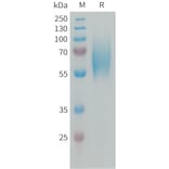 SDS-PAGE - Recombinant Human FGFR2 Protein (6xHis Tag) (A324993) - Antibodies.com