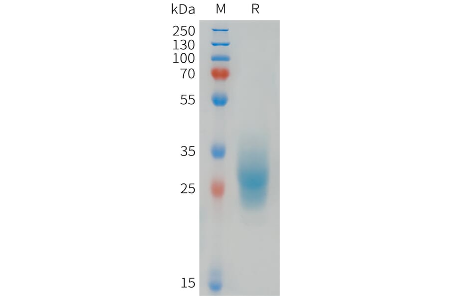 SDS-PAGE - Recombinant Human FOLR3 Protein (6xHis Tag) (A324994) - Antibodies.com