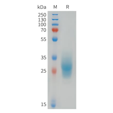 SDS-PAGE - Recombinant Human FOLR3 Protein (6xHis Tag) (A324994) - Antibodies.com