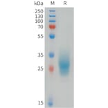 SDS-PAGE - Recombinant Human FOLR3 Protein (6xHis Tag) (A324994) - Antibodies.com