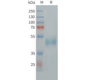 SDS-PAGE - Recombinant Human FSH beta Protein (Fc Tag) (A324995) - Antibodies.com