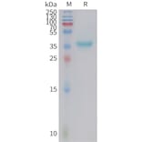 SDS-PAGE - Recombinant Human Galanin Protein (Fc Tag) (A324997) - Antibodies.com
