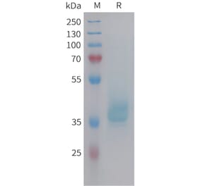 SDS-PAGE - Recombinant Human GIP Protein (Fc Tag) (A325000) - Antibodies.com