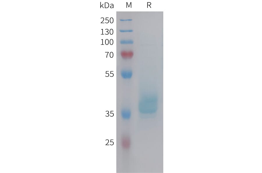 SDS-PAGE - Recombinant Human GIP Protein (Fc Tag) (A325000) - Antibodies.com