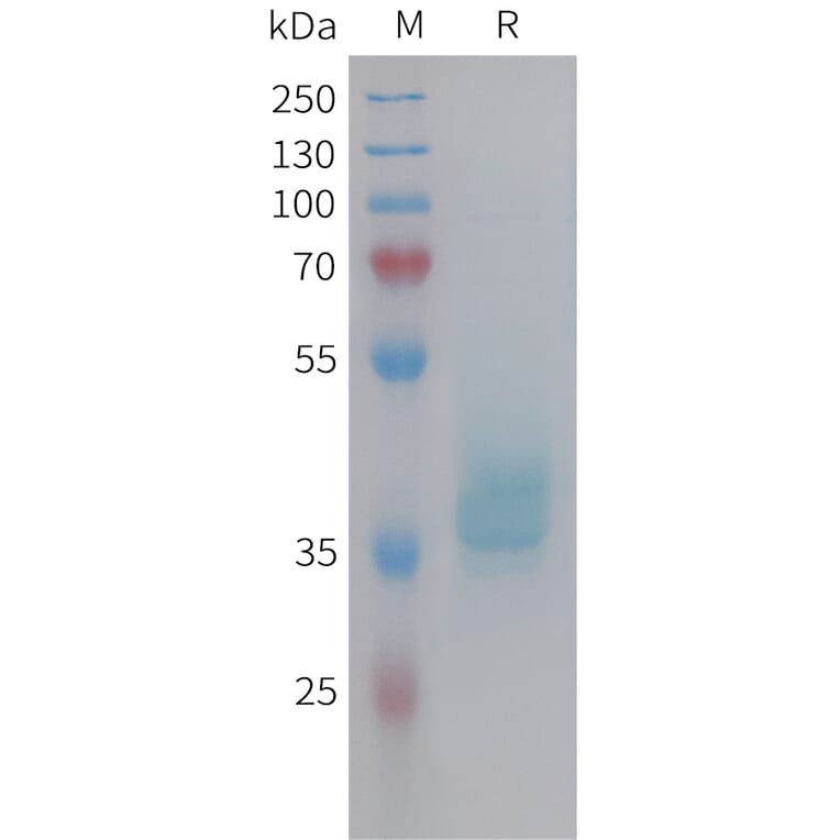 SDS-PAGE - Recombinant Human GIP Protein (Fc Tag) (A325000) - Antibodies.com