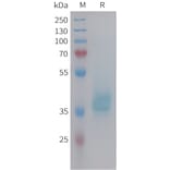 SDS-PAGE - Recombinant Human GIP Protein (Fc Tag) (A325000) - Antibodies.com