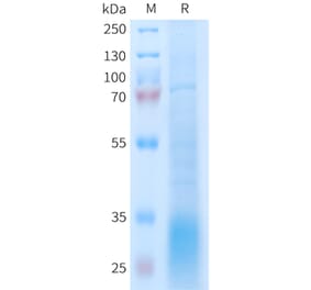 SDS-PAGE - Recombinant Human GLP2R Protein (6xHis Tag) (A325001) - Antibodies.com
