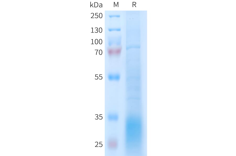 SDS-PAGE - Recombinant Human GLP2R Protein (6xHis Tag) (A325001) - Antibodies.com