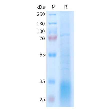 SDS-PAGE - Recombinant Human GLP2R Protein (6xHis Tag) (A325001) - Antibodies.com