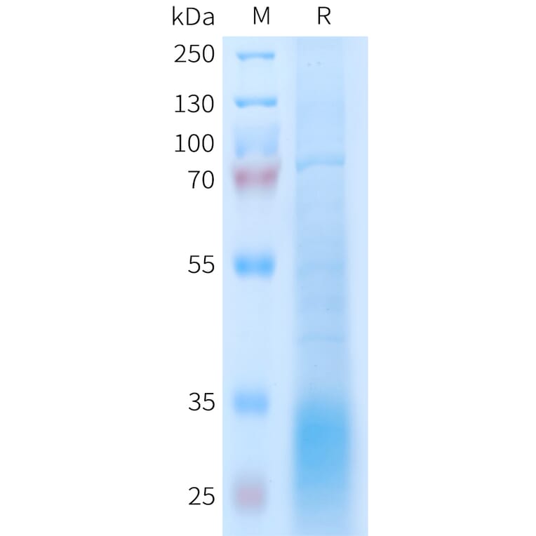 SDS-PAGE - Recombinant Human GLP2R Protein (6xHis Tag) (A325001) - Antibodies.com