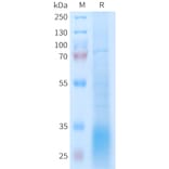 SDS-PAGE - Recombinant Human GLP2R Protein (6xHis Tag) (A325001) - Antibodies.com