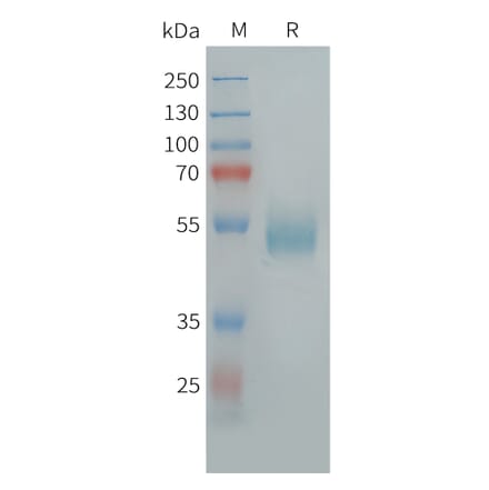 SDS-PAGE - Recombinant Human GPCR GPR14 Protein (Fc Tag) (A325003) - Antibodies.com