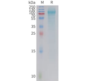 SDS-PAGE - Recombinant Human GPR133 Protein (6xHis Tag) (A325004) - Antibodies.com