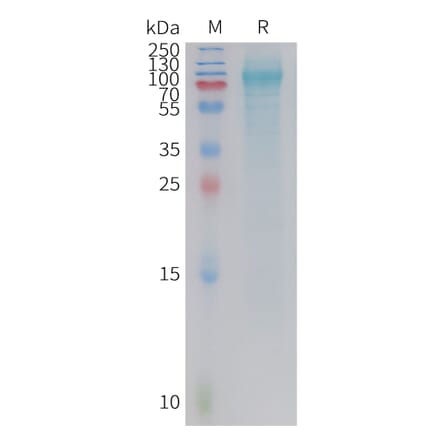 SDS-PAGE - Recombinant Human GPR133 Protein (6xHis Tag) (A325004) - Antibodies.com
