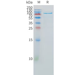 SDS-PAGE - Recombinant Human HGF Protein (Fc Tag) (A325006) - Antibodies.com