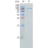 SDS-PAGE - Recombinant Human HGF Protein (Fc Tag) (A325006) - Antibodies.com