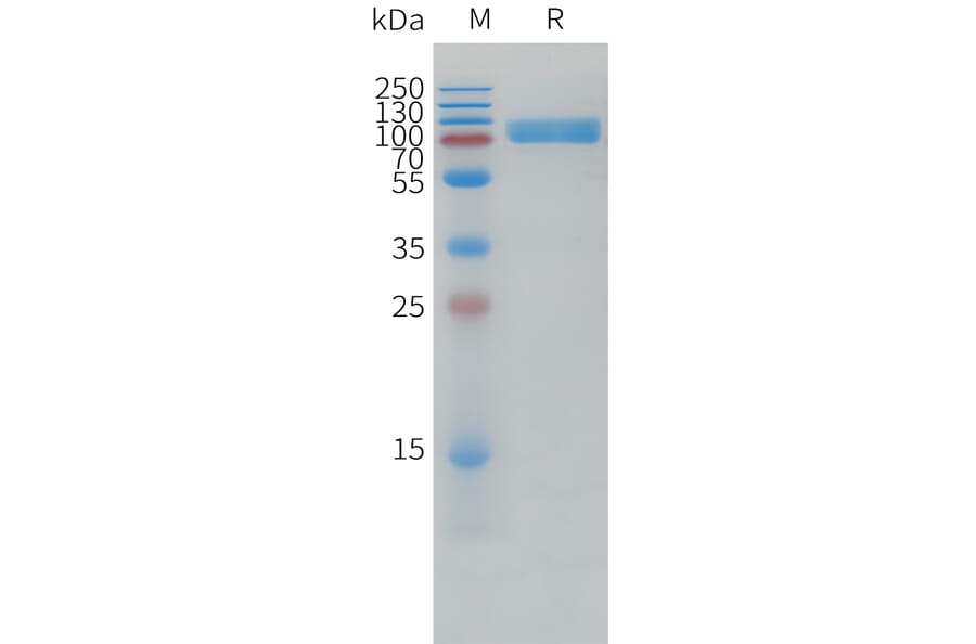 SDS-PAGE - Recombinant Human IL1 Receptor I/IL-1R-1 Protein (Fc Tag) (A325008) - Antibodies.com