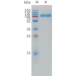 SDS-PAGE - Recombinant Human IL1 Receptor I/IL-1R-1 Protein (Fc Tag) (A325008) - Antibodies.com