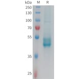 SDS-PAGE - Recombinant Human IL-25 Protein (Fc Tag) (A325009) - Antibodies.com