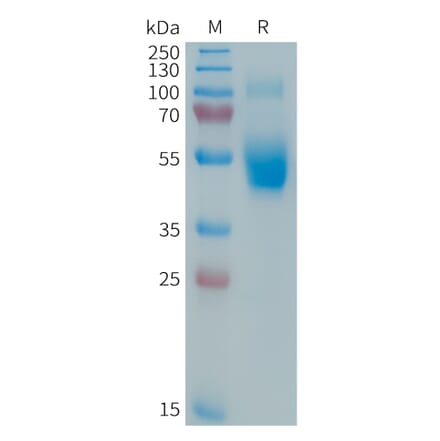 SDS-PAGE - Recombinant Human IL-3 Protein (Fc Tag) (A325010) - Antibodies.com