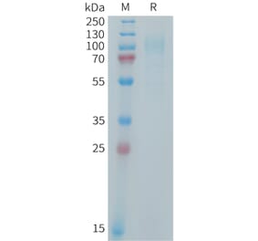 SDS-PAGE - Recombinant Human IL-31RA Protein (6xHis Tag) (A325011) - Antibodies.com