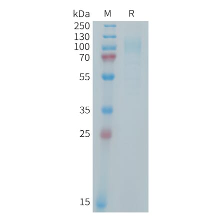 SDS-PAGE - Recombinant Human IL-31RA Protein (6xHis Tag) (A325011) - Antibodies.com