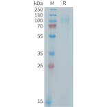 SDS-PAGE - Recombinant Human IL-31RA Protein (6xHis Tag) (A325011) - Antibodies.com