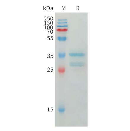 SDS-PAGE - Recombinant Human IP10 Protein (Fc Tag) (A325013) - Antibodies.com