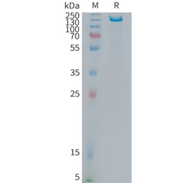 SDS-PAGE - Recombinant Human ITGB6 Protein (Fc Tag) (A325014) - Antibodies.com