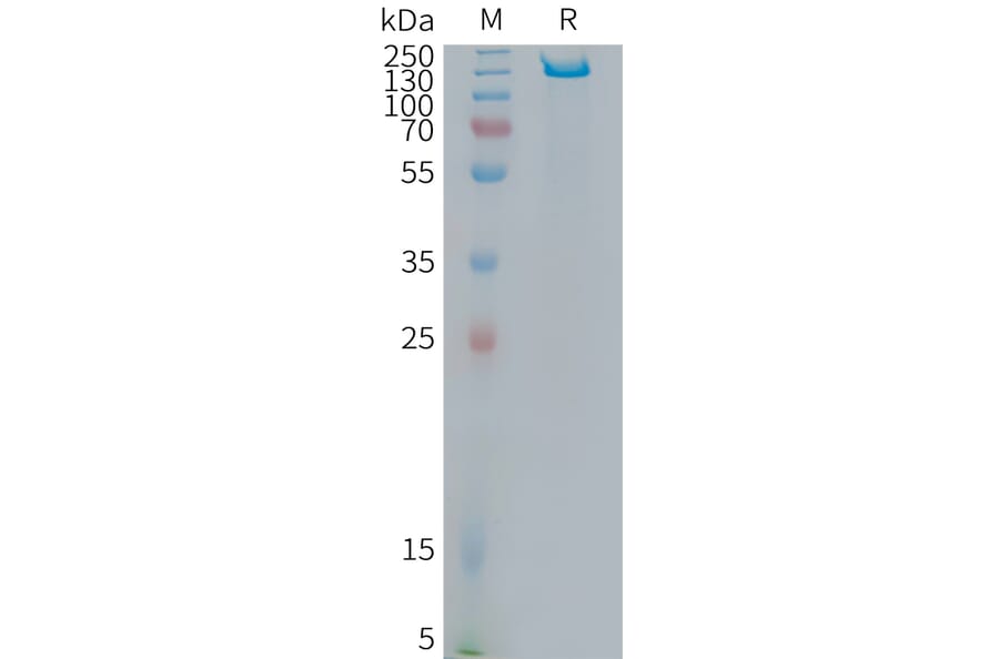 SDS-PAGE - Recombinant Human ITGB6 Protein (Fc Tag) (A325014) - Antibodies.com