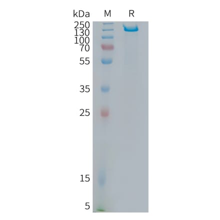 SDS-PAGE - Recombinant Human ITGB6 Protein (Fc Tag) (A325014) - Antibodies.com