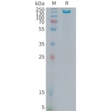 SDS-PAGE - Recombinant Human ITGB6 Protein (Fc Tag) (A325014) - Antibodies.com