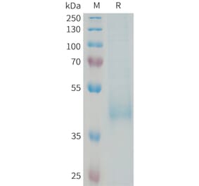 SDS-PAGE - Recombinant Human KIR3DL3 Protein (6xHis Tag) (A325016) - Antibodies.com