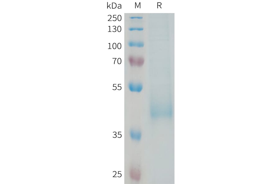 SDS-PAGE - Recombinant Human KIR3DL3 Protein (6xHis Tag) (A325016) - Antibodies.com