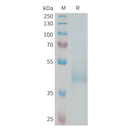 SDS-PAGE - Recombinant Human KIR3DL3 Protein (6xHis Tag) (A325016) - Antibodies.com
