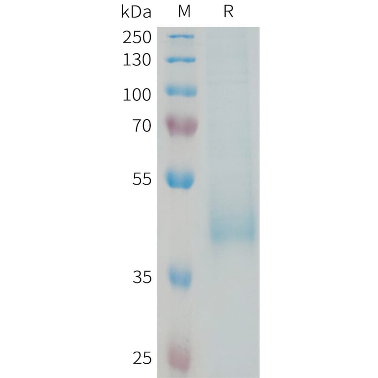 SDS-PAGE - Recombinant Human KIR3DL3 Protein (6xHis Tag) (A325016) - Antibodies.com
