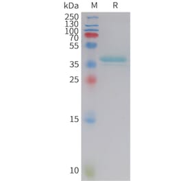 SDS-PAGE - Recombinant Human Leptin Protein (Fc Tag) (A325017) - Antibodies.com
