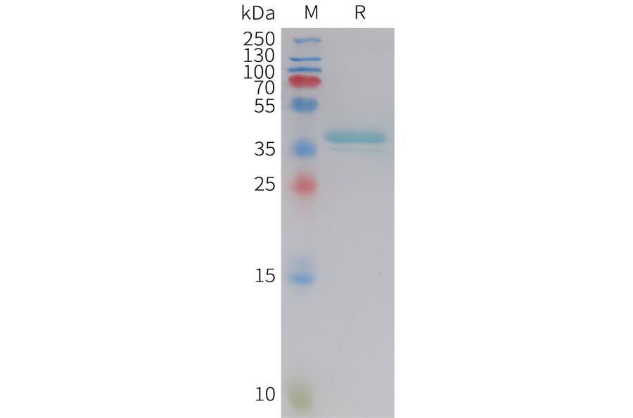 SDS-PAGE - Recombinant Human Leptin Protein (Fc Tag) (A325017) - Antibodies.com