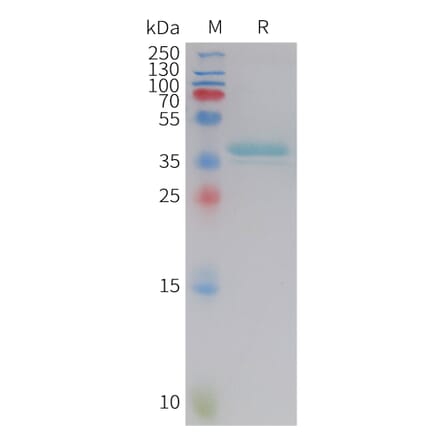 SDS-PAGE - Recombinant Human Leptin Protein (Fc Tag) (A325017) - Antibodies.com