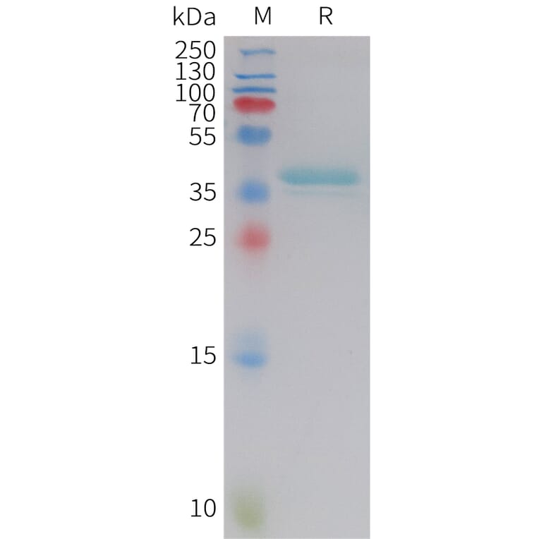 SDS-PAGE - Recombinant Human Leptin Protein (Fc Tag) (A325017) - Antibodies.com