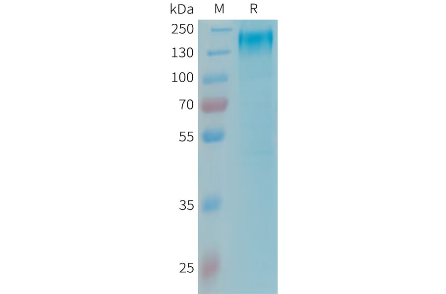 SDS-PAGE - Recombinant Human Leptin Receptor Protein (6xHis Tag) (A325018) - Antibodies.com