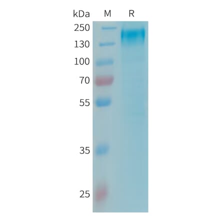 SDS-PAGE - Recombinant Human Leptin Receptor Protein (6xHis Tag) (A325018) - Antibodies.com