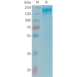 SDS-PAGE - Recombinant Human Leptin Receptor Protein (6xHis Tag) (A325018) - Antibodies.com
