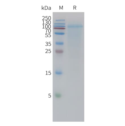 SDS-PAGE - Recombinant Human Lingo1 Protein (6xHis Tag) (A325021) - Antibodies.com